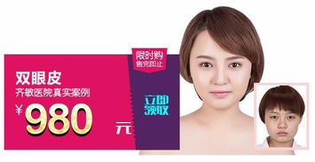 鞍山齊敏 980元雙眼皮手術(shù)，開啟美麗雙眸新篇章
